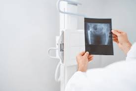 Tryout Online Simulasi Radiografer: Persiapan Optimal untuk Kesuksesan Anda