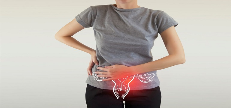 Gaya Hidup untuk Menurunkan Risiko Terkena Kista pada Perempuan